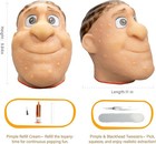 2026 New Pimple Popping Stress Relief Toy     Refillable Big Head Squeeze Pimpl   
