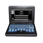 With 4 Probe Portable Laptop Machine Digital Ultrasound Scanner High Resolution