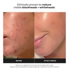 Paula s Choice Skin Perfecting 2 Bha Liquid Exfoliant 4oz 118ml Expiration 12 26