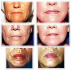 Glycolic Acid 5-40  Chemical Peel 1 2 Oz Aha Wrinkles Acnes Blackheads Skin Face