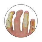 Hand Osteoarthritis  oa  Gpi Anatomical Model Lfa   1930 make Us An Offer  Video