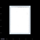 Vintage Photo Man With Glasses Sitting Outside