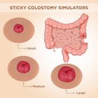 Sticky Colostomy Simulators  Stoma Training Model Set  Multi-skin Tone Ostomy   