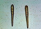 2 Antique  Microscope Slides   Diatoms Aulacodiscus  Climocosphenia By W watson