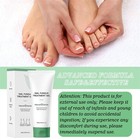 New Us Nutraboost Nail Fungus Treatment Gel  Nail Fungus  Fungus Cream  1pcs 