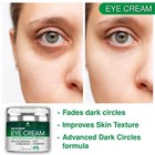 Eye Cream For Dark Circles And Puffiness  Day   Night Bags Under Eyes Treatment