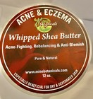 Acne   Eczema Whipped Shea Butter 12 Oz