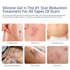 100  Silicone Scar Gel Scar Cream - Advanced Scar Gel For Surgical Scars  C-sect