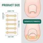 Ingrown Toenail Treatment  60pcs Breathable Ingrown Toenail Strips painless