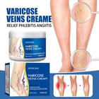Varicose Veins Treatment Cream Vasculitis Phlebitis Spider Relief Pain Ointment