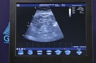 Ge Healthcare Vivid S6 Cardiovascular Ultrasound System