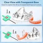 Dental Implant Model Overdenture Upper lower Jaw 4 Implant Clear Detachable Us