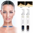 Red   Blue Light Picosecond Laser Tattoo Removal Pen Mole Dark Spot Remover Tool