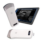 Wireless Ultrasound Probe Scanner Portable Machine Support Ios Android Windows