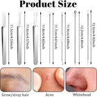 7pcs Pimple Remover Tool Kit Blackhead Extractor Comedone Acne Spot Popper Hot