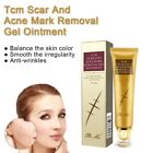 Scar Acne Stretch Mark Removal Ointment Gel Cream Wounds Cuts Burns Treatment 