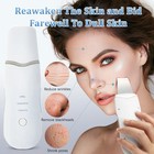 Skin Scrubber Vibration Face Spatula Peeling Blackhead Remover Facial Lifting