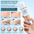 Advanced Scar Gel  Silicone Scar Gel  Treats Old And New Scars  Reduces The A   