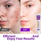 12  Azelaicacid Cream W  Nicotinamide   Vitamin C