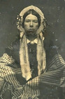 Rare Antique Daguerreotype Medical Mumps Photo Half Case Victorian Woman Unique
