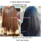 4 Step Hair Growth System Bundle For Thicker Fuller Hair In Weeks