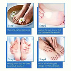 60  Urea Foot Cream For Cracked Heels Dry Skin Intensive Moisturizing Repair Car