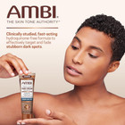 Ambi Skin Dark Spot Fade Cream Lightening Bleaching Cream Dark Spot Whitening