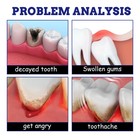 Relief Swollen Gums Periodontitis Relief Ointment Remove Antibacterial Oral Care