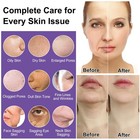 Skin Care Set 6pcs Womens Teens Tighten Lift Firm Hydrate Anti-aging Facial Kit