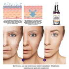 Glo Vous Derm Luxe Serum 2024 Best Glo Vous Derm Luxe Anti Aging Serum