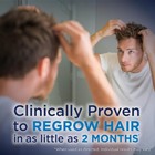 Amazon Basic Care Minoxidil 5  Hair Regrowth Men 12 Bottles  2 Pack  Exp 07 2026