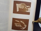 1910  Freaks Salp  tri  re Medical Journal Oddities Antique Book  0 Tariffs