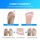 2 Pcs Bunion Corrector Silicone Toe Separator Straightener Orthopedic Toes Space