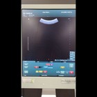 Bk Medical Flex Focus 1500 Ultrasound With 2 Probes 8830  8870 