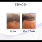 Zenagen Revolve Men s Thickening Shampoo   Conditioner 16oz Duo Set