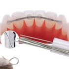 Us Dental Bracket Lingual Orthodontic Retainer Wire Stainless Steel  010 x 028 