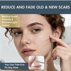 Silicone Scar Reducer Sheets Ultra-thin Washable 1 6 x60  Stretch Mark