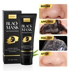 Ylnalo Blackhead Remover Mask Kit  Charcoal Peel For All Skin Types  3 5 Fl oz 