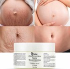 Stretch Marks And Scars Removal Cream For Pregnancy 