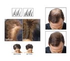 Hair Building Fibers Keratin For Hair Loss Concealer Hair Styling Refill Bag Lg