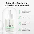 Lanbena Acne Clear Serum - Acne Treatment For Clear  Smooth Sensitive Skin - 1oz