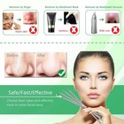 5pcs Blackhead Remover Tool Kit Comedone Extractor Acne Tweezers