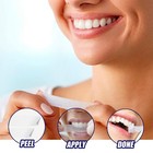 Professional Teeth Whitening Strips For Stain Removal And Bright White Smile