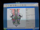 Laptop W validated Myovision 8000 Software Installed Ready To Use  Chiropractic 
