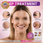 6 Pack Of Sheet Face Masks Skincare - Collagen Face Mask Sheets With Hyaluronic 