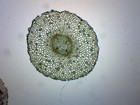 Old   Young Dicot Roots  - Cs - Prepared Slide - 75x25mm - Eisco Labs