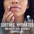 Chapstick Classic Medicated Lip Balm Tubes  Chapped Skin Protectant - 0 15x12 Oz