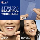 Crest 3d Whitestrips Professional White Teeth Whitening Kit 20 Treatments