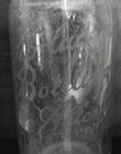 Horlacher Bottling Co Allentown Pa Beer   Brewery Prohibition Era Seltzer Bottle