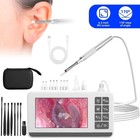 Tongwode Ear Endoscope Camera 4 3  Lcd Screen Otoscope With Wax Removal Tools